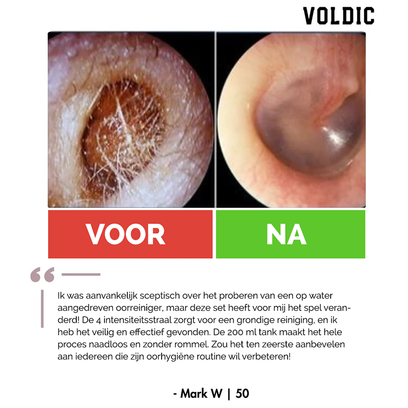 Voldic™ Elektrisch Oorreinigingsset voor Oorsmeer